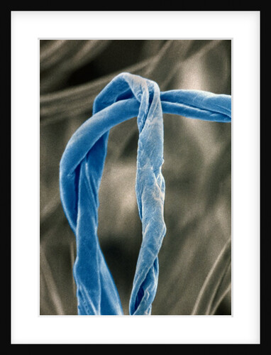 Cotton Fibers by Anonymous