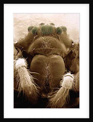Microscopic View of Black Widow by Anonymous