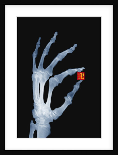 Skeletal Hand Holding Computer Chip by Anonymous