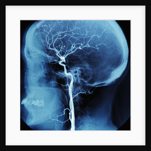 X-Ray of Human Head by Anonymous