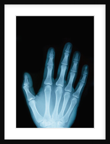 X-Ray of a Hand by Anonymous