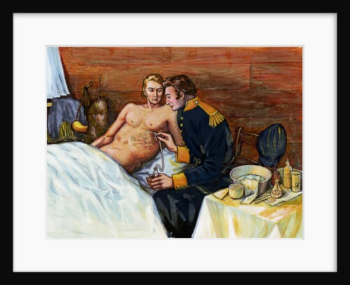 Illustration of Dr. William Beaumont Inserting Tube In Alexis St. Martin's Torso by Anonymous