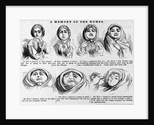 The memory of the mumps by Anonymous