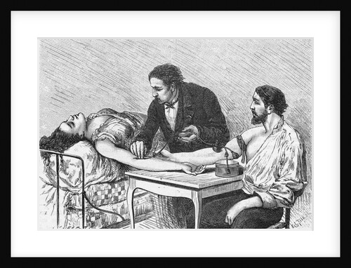 Illustration of a Woman Receiving a Blood Transfusion in February 1882 by Anonymous