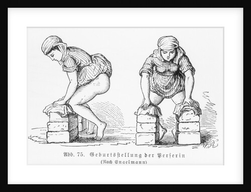 Illustration of a Birthing Position for Woman by Anonymous