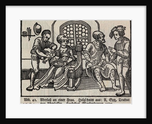 Bloodletting of Woman by Anonymous