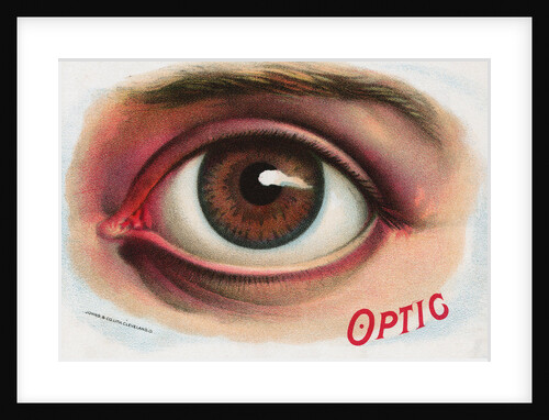 Advertisement for Contact Lenses by Anonymous