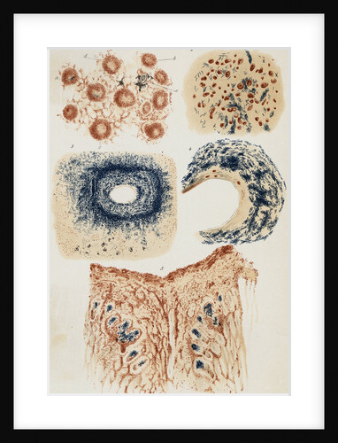 Illustration Depicting Infected Cells by Anonymous