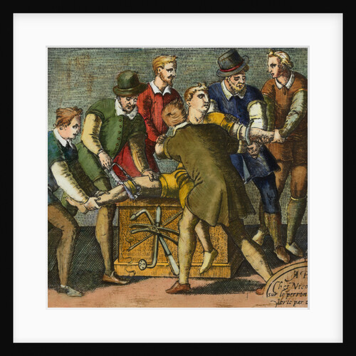 Physician and Assistants during Early History Leg Amputation by Anonymous