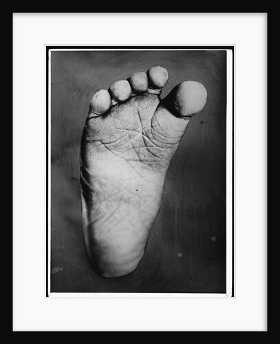 Foot of Young Boy by Anonymous