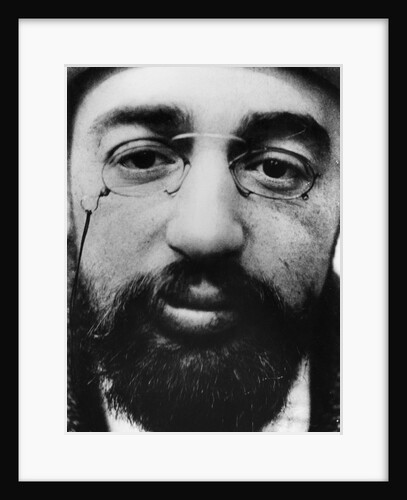 Face of French Artist Henri de Toulouse-Lautrec by Anonymous