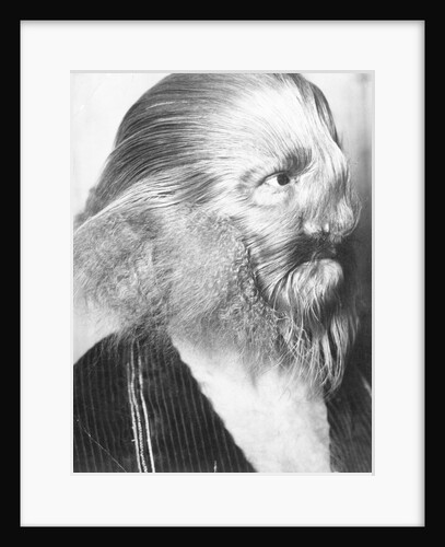 Portrait of a Genetically Hairy Man by Anonymous