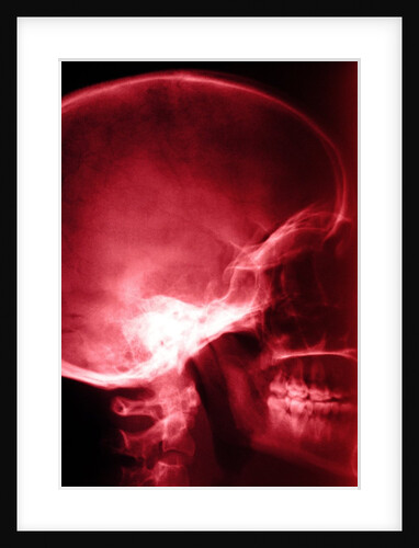 X-Ray of Human Skull by Anonymous