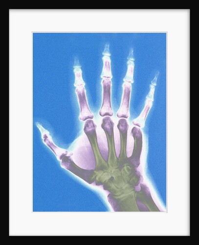 X-ray of a Hand by Anonymous