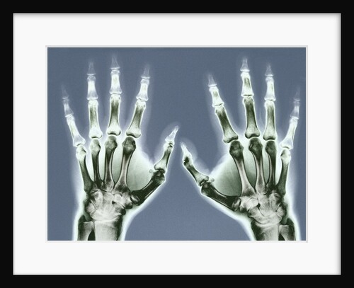 X-ray of Hands by Anonymous