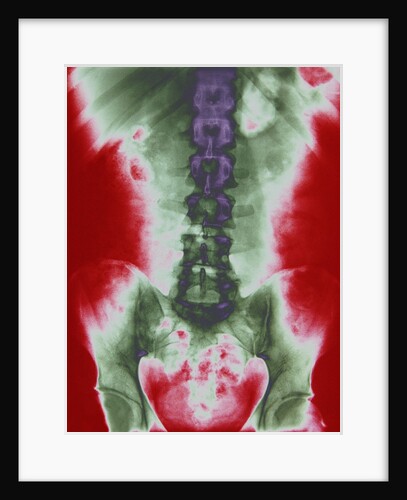 X-ray of a Torso by Anonymous