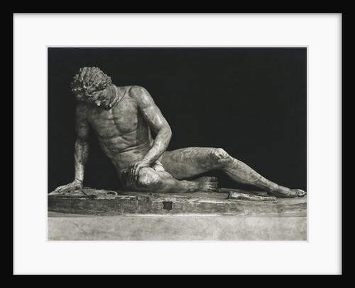 Sculpture of Man Partially Overcome by Anonymous