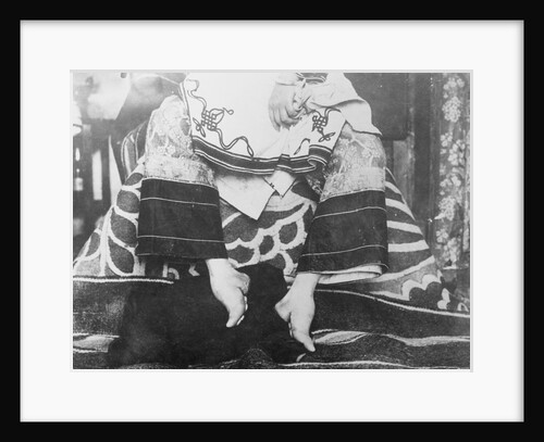 Portrait of Chinese Foot Binding by Anonymous
