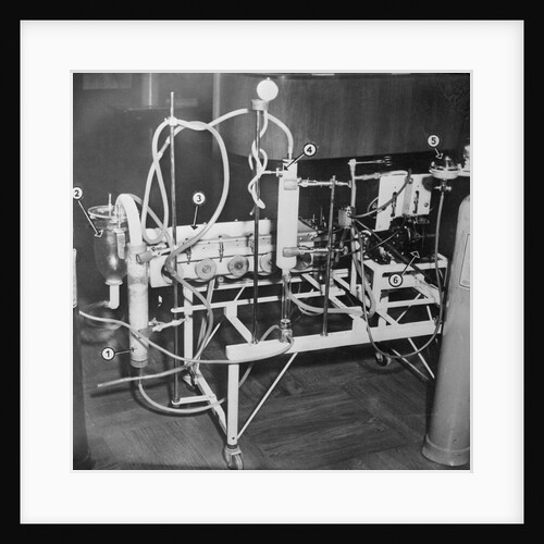 Early Heart and Lung Machine by Anonymous