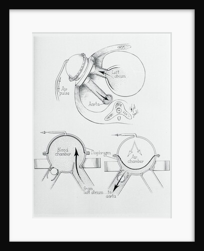 Diagram of Artificial Heart Compression by Anonymous