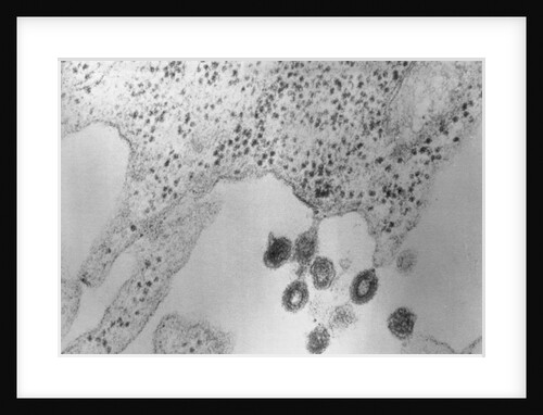 Tumors Budding from Cell Membrane by Anonymous