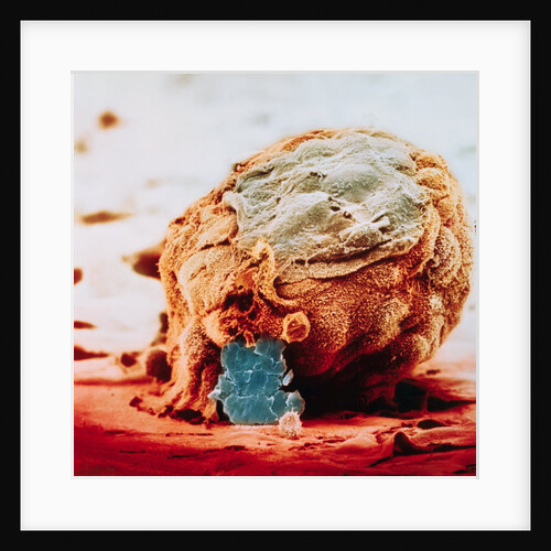 Human Embryo in Early Stages by Anonymous