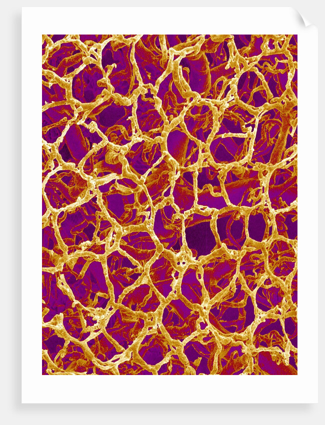 Blood Vessel Cast from Colon of a Rat by Anonymous