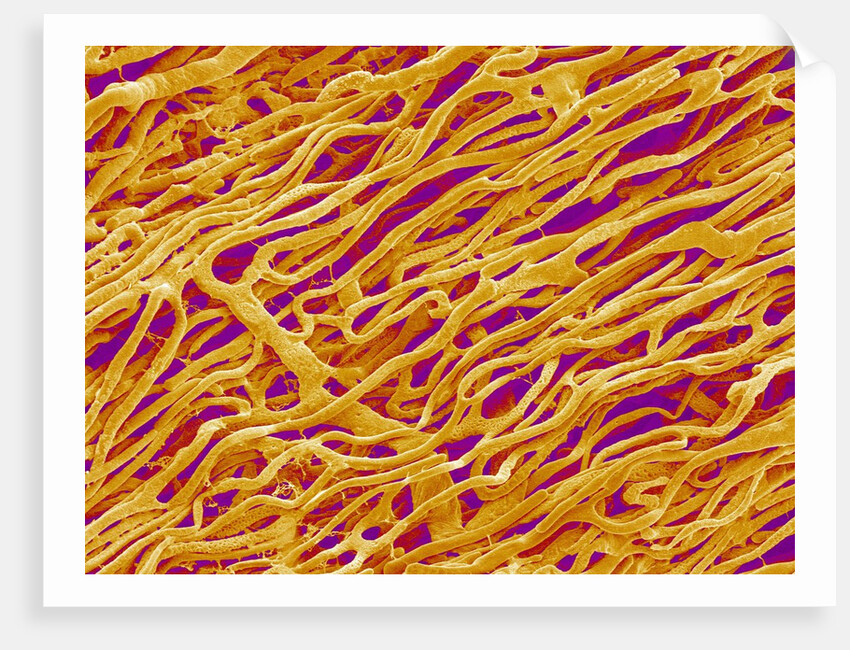 Blood Vessel Cast in Heart of a Rat by Anonymous