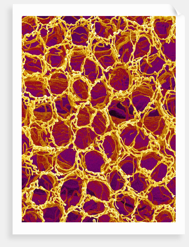 Blood Vessel Cast from Stomach of a Rat by Anonymous