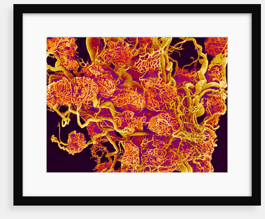 Blood Vessels and Corpus Luteum in Ovary of a Frog by Anonymous
