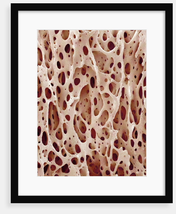 Bone Tissue by Anonymous
