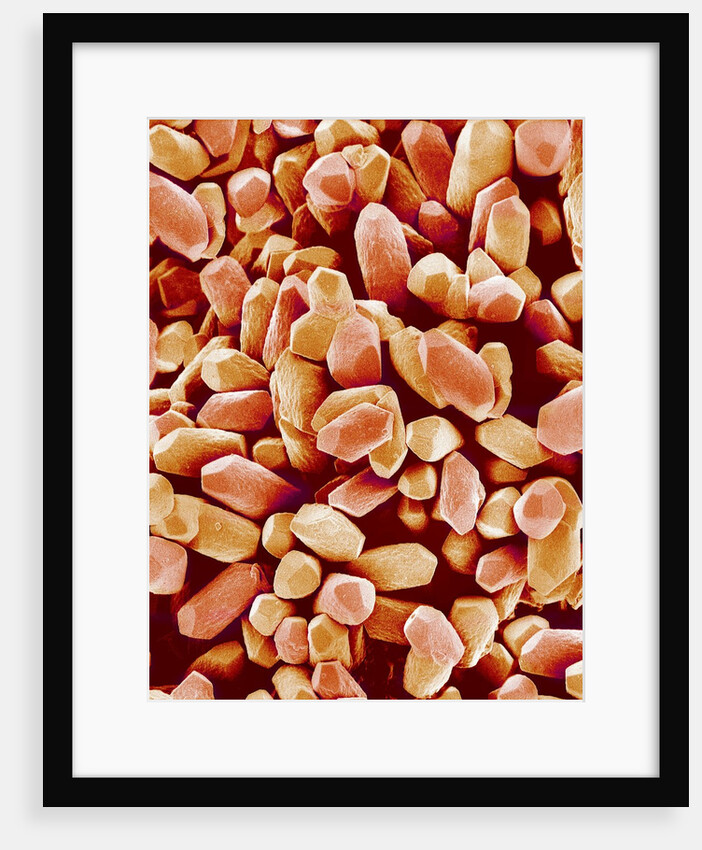 Otoliths of a Rabbit by Anonymous