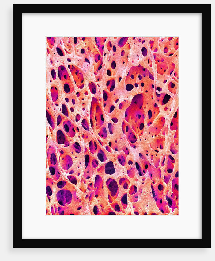 Bone Tissue of Chicken by Anonymous