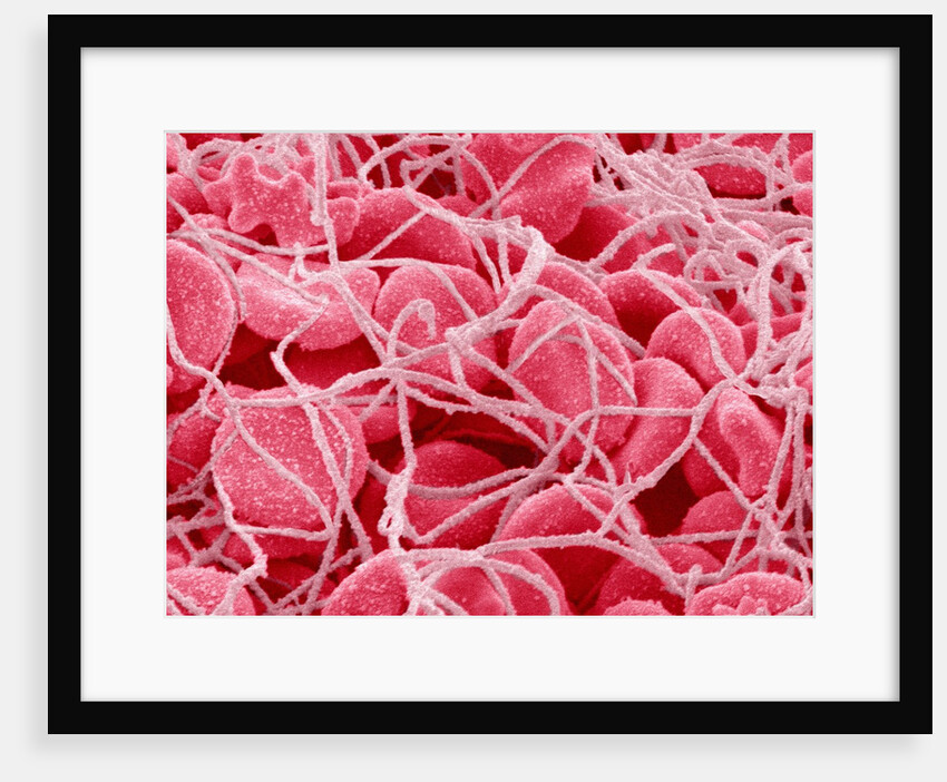 Coagulated Red Blood Cells by Anonymous