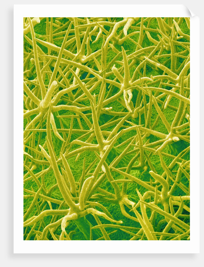 Underside of Marsh Mallow Leaf by Anonymous