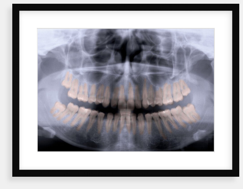 Panoramic X-Ray of Mouth by Anonymous