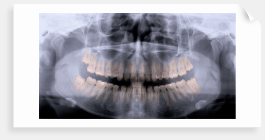 Panoramic X-Ray of Mouth by Anonymous