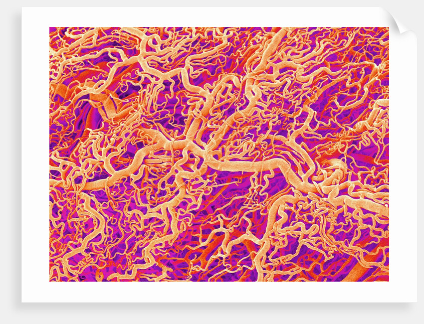 Blood Vessel Cast of Connective Tissue of a Rat by Anonymous