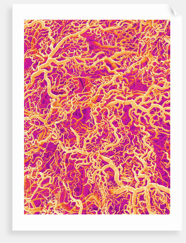 Blood Vessel Cast of Connective Tissue of a Rat by Anonymous
