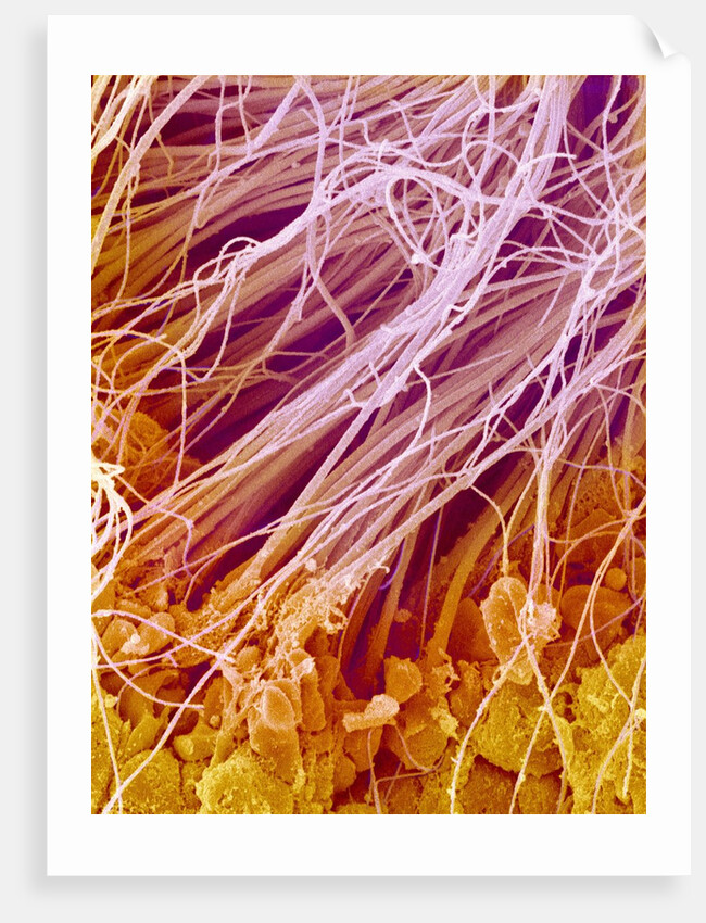 Sperm in Testis of a Rat by Anonymous