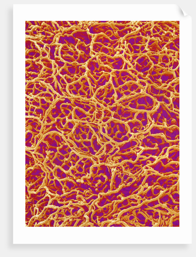 Blood Vessel Cast from Rat Colon by Anonymous