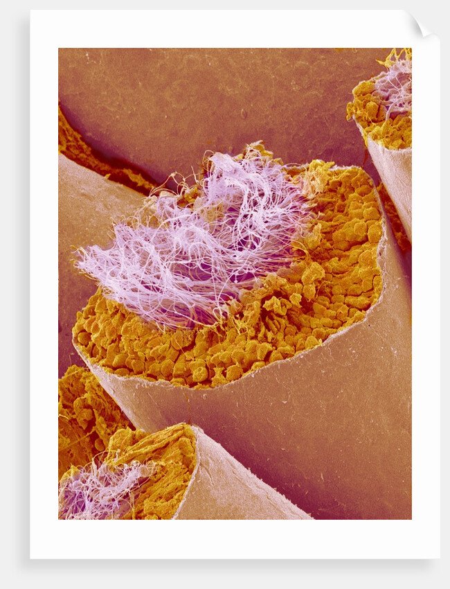 Sperm in Testis of a Rat by Anonymous