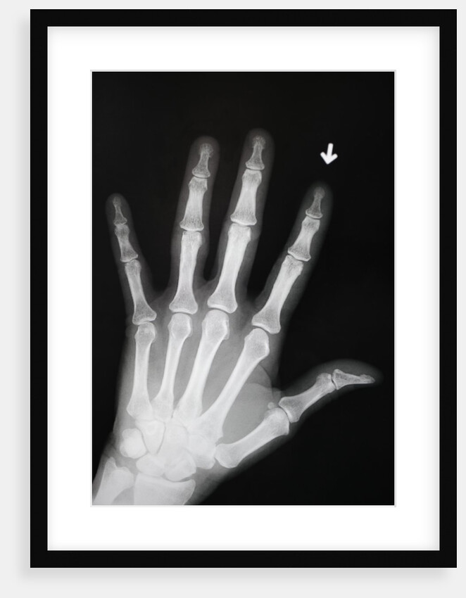 Hand Bones by Anonymous