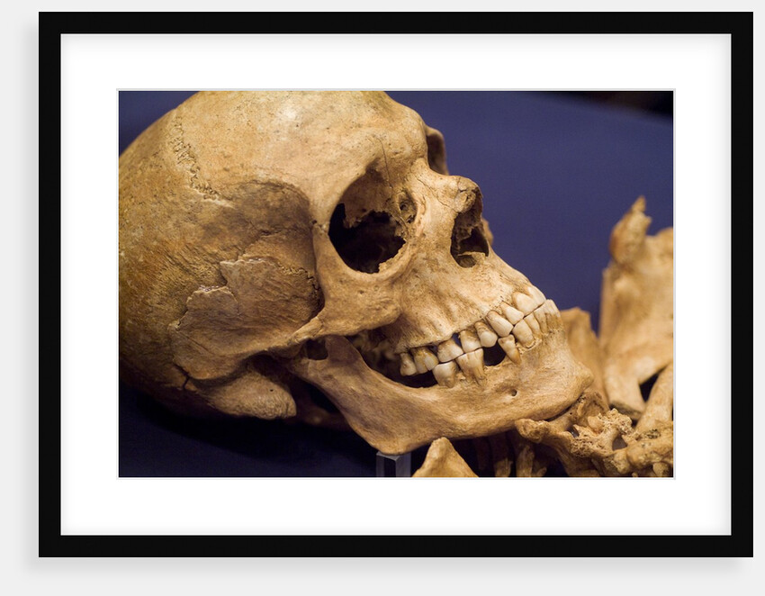 Skull of Early Settler by Anonymous