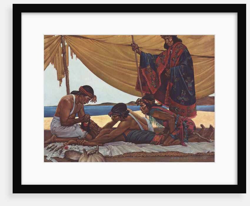 Trephining in Ancient Peru by Robert Thom