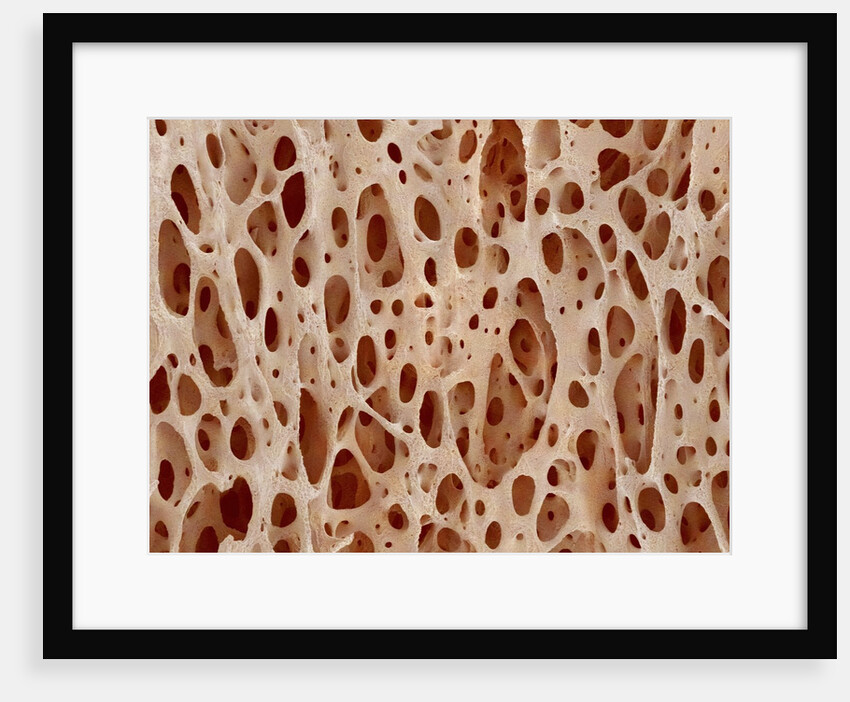 Bone tissue of a hen magnified x25 by Anonymous