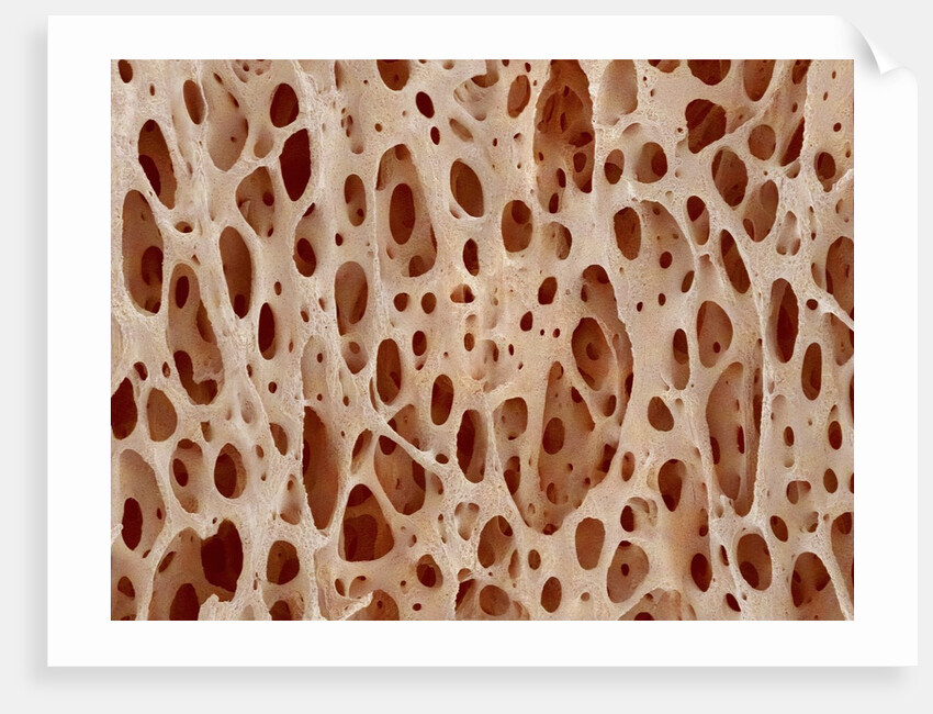 Bone tissue of a hen magnified x25 by Anonymous