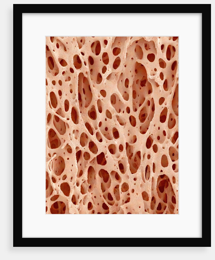 Bone tissue of a hen magnified x25 by Anonymous