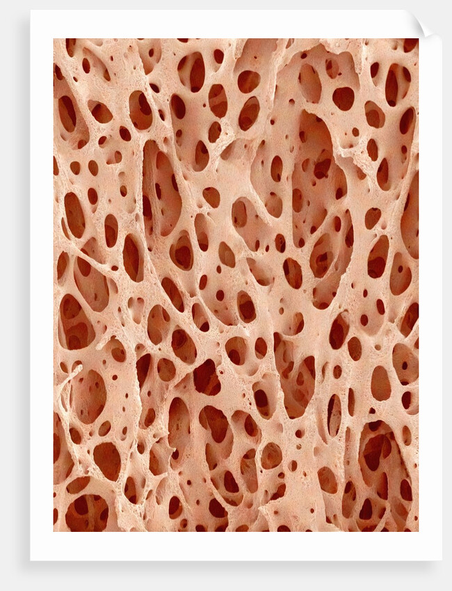 Bone tissue of a hen magnified x25 by Anonymous