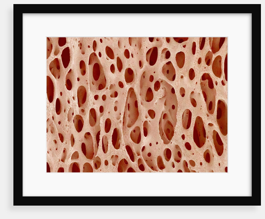 Bone tissue of a hen magnified x25 by Anonymous